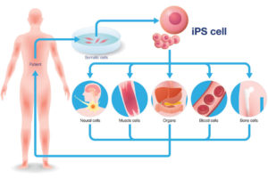 Kožní buňky a nesmrtelnost - IPS
